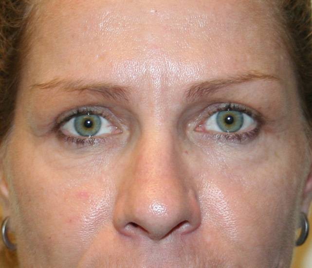 Top 90+ Wallpaper Pictures Of Poison Ivy On Eyelid Full HD, 2k, 4k