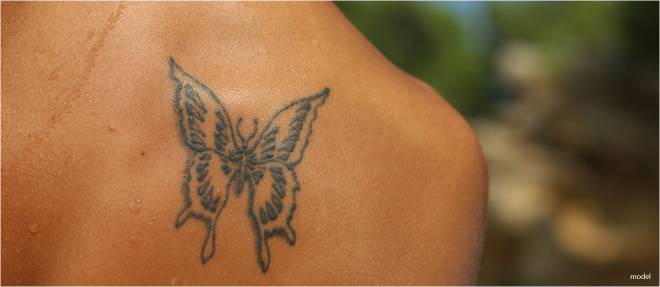 tattoo and skin cancer
