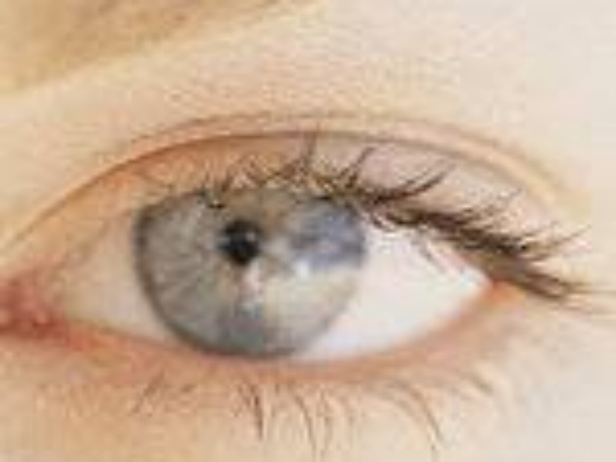 monthly b12 injection black eyes How To Get Rid of a Eye Dark circles are one of