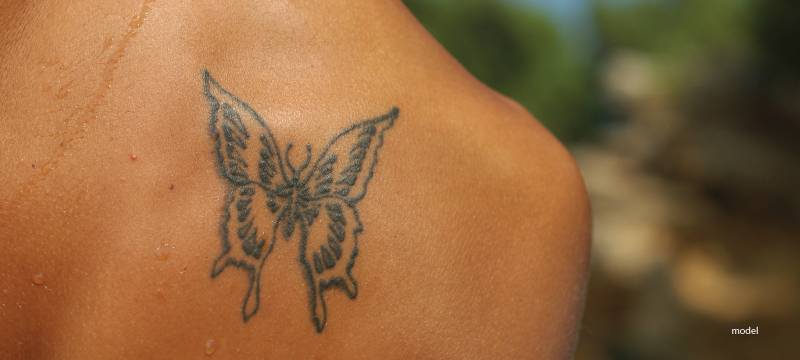 Why Laser Tattoo Removal Sessions Must Be Spaced Out
