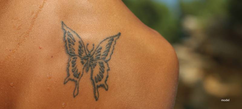 Why Laser Tattoo Removal Sessions Must Be Spaced Out Why Laser Tattoo Removal Sessions Must Be Spaced Out