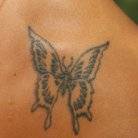 speed up tattoo removal