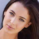 common rosacea triggers