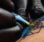 color tattoo removal