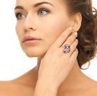 Poikiloderma of Civatte