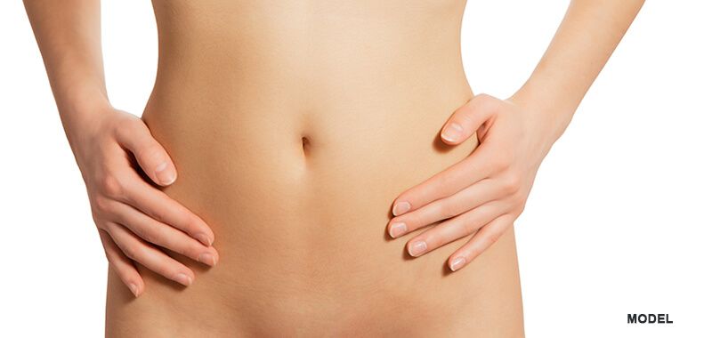 Treating Excess Fat In The Pubic Area (FUPA) - Westlake Dermatology