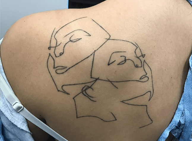 Austin Laser Tattoo Removal - New PiQo4 Laser Austin Laser Tattoo Removal - New PiQo4 Laser