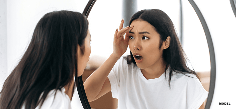 woman looking fungal acne