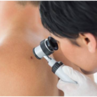 melanoma screening