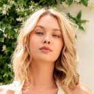 Woman dermal filler model