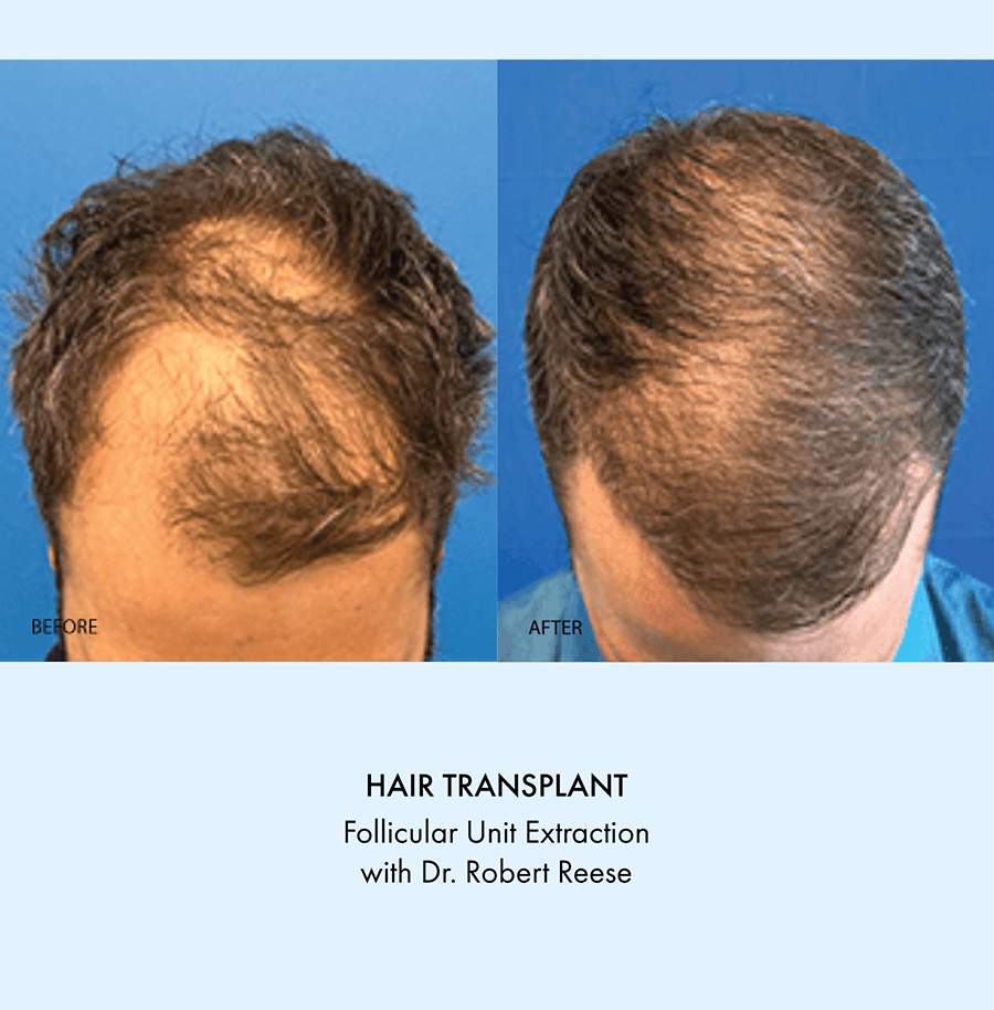 Westlake Dermatology and Cosmetic Surgery