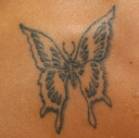 tattoo removal facts